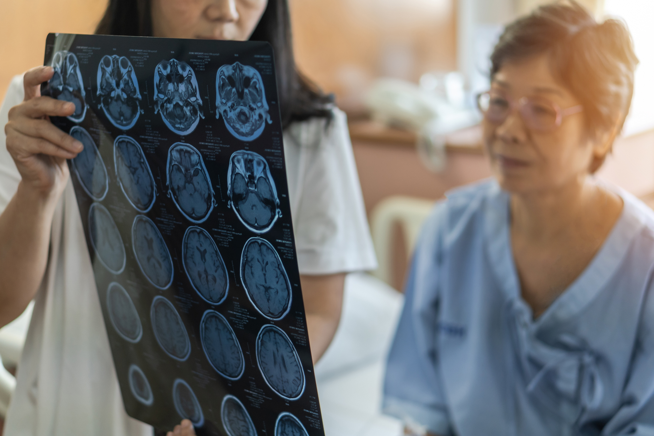 A female white doctor with long black hair holds up the results of a brain scan to an older Asian woman who sits in a hospital bed wearing glasses and a blue hospital gown